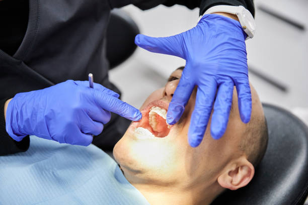 Best Emergency Tooth Extraction in Portales, NM